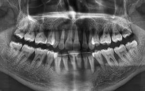 Semia mounia ky0q21 - Eugenol