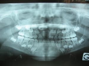 Serra maeline nov lpdays - Eugenol