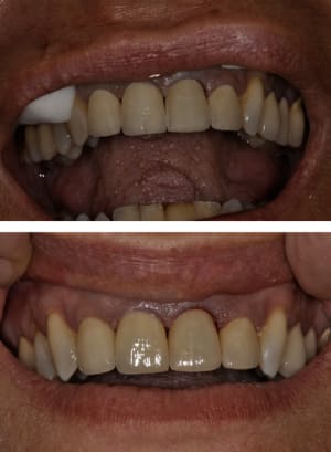 Sans titre 3 e4ns8a - Eugenol