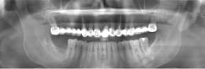 Sans titre immh3w - Eugenol