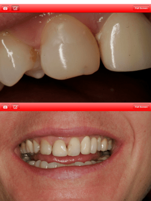 Screenshot v0rxj2 - Eugenol