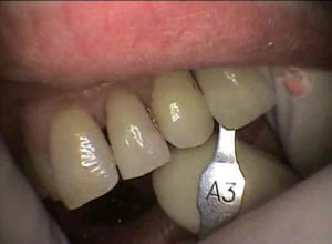 Sopro 2 iai411 - Eugenol