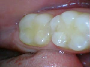 Stillcap0044 idqsam - Eugenol