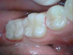 Stillcap0049 ob6ncz - Eugenol