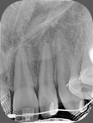 Unknown x 2013 01 30 14 31 15 4 biupl6 - Eugenol