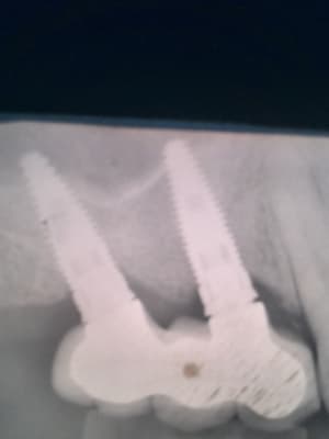 Vp5 pdo3oe - Eugenol