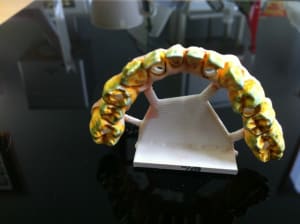 Zircone t int e au pinceau 8 couches par dents vxnotj - Eugenol