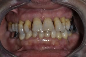  dsc0004 oneotu - Eugenol