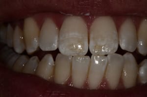  dsc2021 nwzmcy - Eugenol