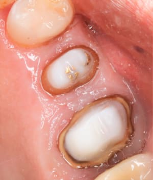  mg 1883 vnrt73 - Eugenol