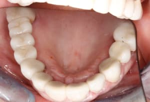  mg 1947 kffz5n - Eugenol