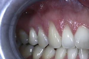  mg 2035 ruvbeh - Eugenol