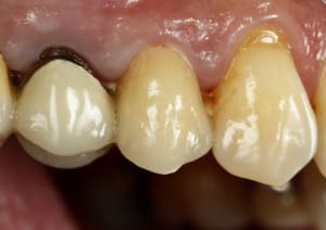  mg 4981 betxzf - Eugenol