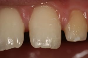  mg 7468 dssetm - Eugenol