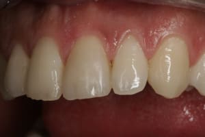  mg 8277 zezu09 - Eugenol