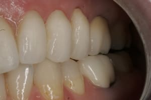  mg 8511 ywzw9k - Eugenol