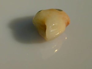 oro céram gtat4w - Eugenol