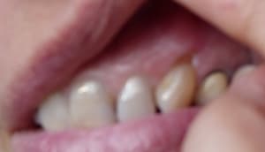 A pof9mt - Eugenol