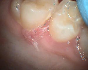 Agathe wnjgnv - Eugenol