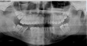 Agznst1fsqkatxhsme0u - Eugenol
