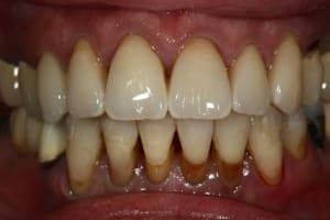 Aie  1  pc1kfk - Eugenol