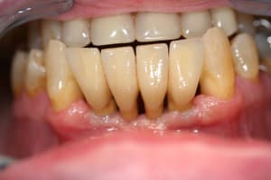 Aout 2007 bk5pzo - Eugenol