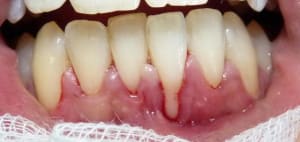 Ap j62xsl - Eugenol