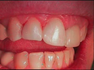 Apres tant pis  l4gqym - Eugenol