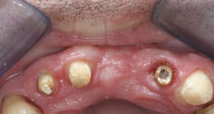Apres zgvhf0 - Eugenol