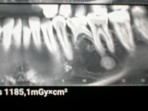 Apzg85kz9p6y3ljxd6hz - Eugenol