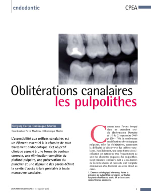 Article pulpolithe hh7qpi - Eugenol