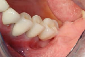 Autre vue gf8m4m - Eugenol