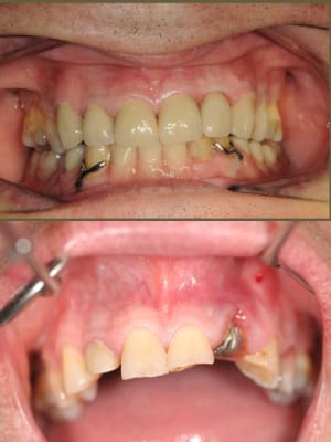 Avant apr s lwq1fz - Eugenol