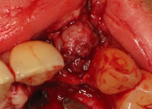 Avl gsning iz6lsc - Eugenol