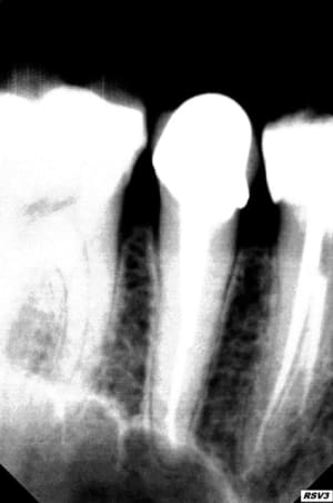 Bad2 nmuvre - Eugenol