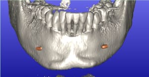 Baron audrey aper u4 yv5ebl - Eugenol