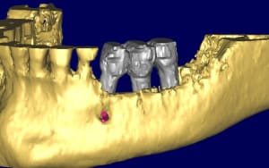Bernard 3d1 tranjs - Eugenol