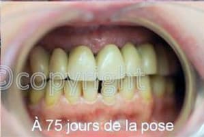 Bip gamma zambk0 - Eugenol