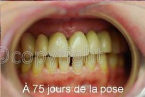 Bip origine hfv47r - Eugenol