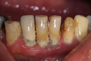 Blanchiment1 l4bsdh - Eugenol