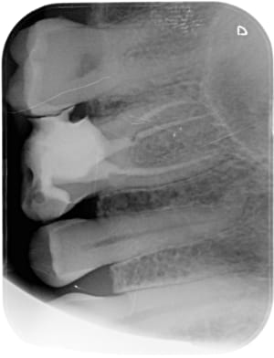 Bov3etsf5frticyipn2z - Eugenol