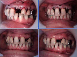 Bridge 2 bmzmbn - Eugenol