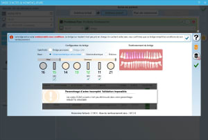 Bridge apjr03 - Eugenol