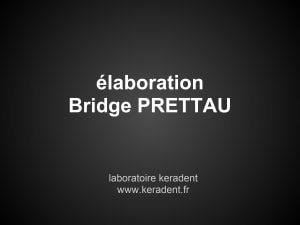 Bridge prettau rcfc4f - Eugenol