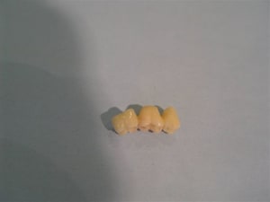Bridge temp 3 ps5kyh - Eugenol