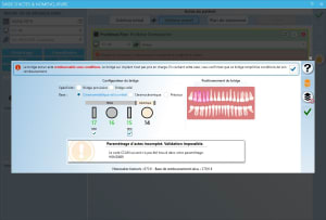 Bridge ukkznt - Eugenol