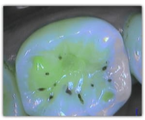 Cas cliniques 1 visuel 2 wgftez - Eugenol