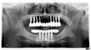 Cas 1 isluxx - Eugenol