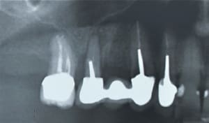 Casi iv18sd - Eugenol