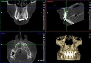 Cbct2 vwykyh - Eugenol